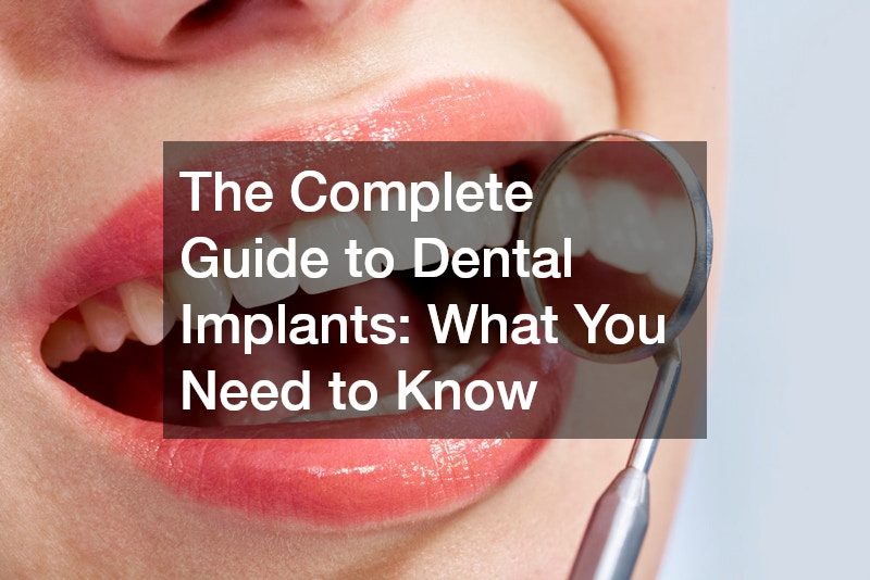 The Complete Guide to Dental Implants  What You Need to Know